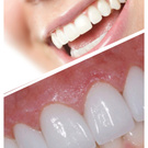 Зубы (имплантация, эстетичность, необходимость)