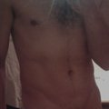 Skip22cm