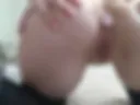My holes