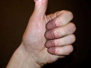 My Photos