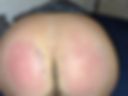 freshly  spanked red hot ass
